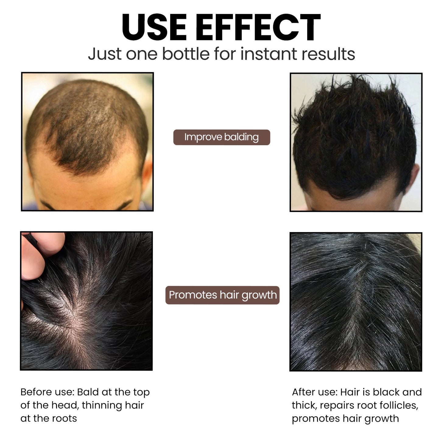 Hair Loss essence